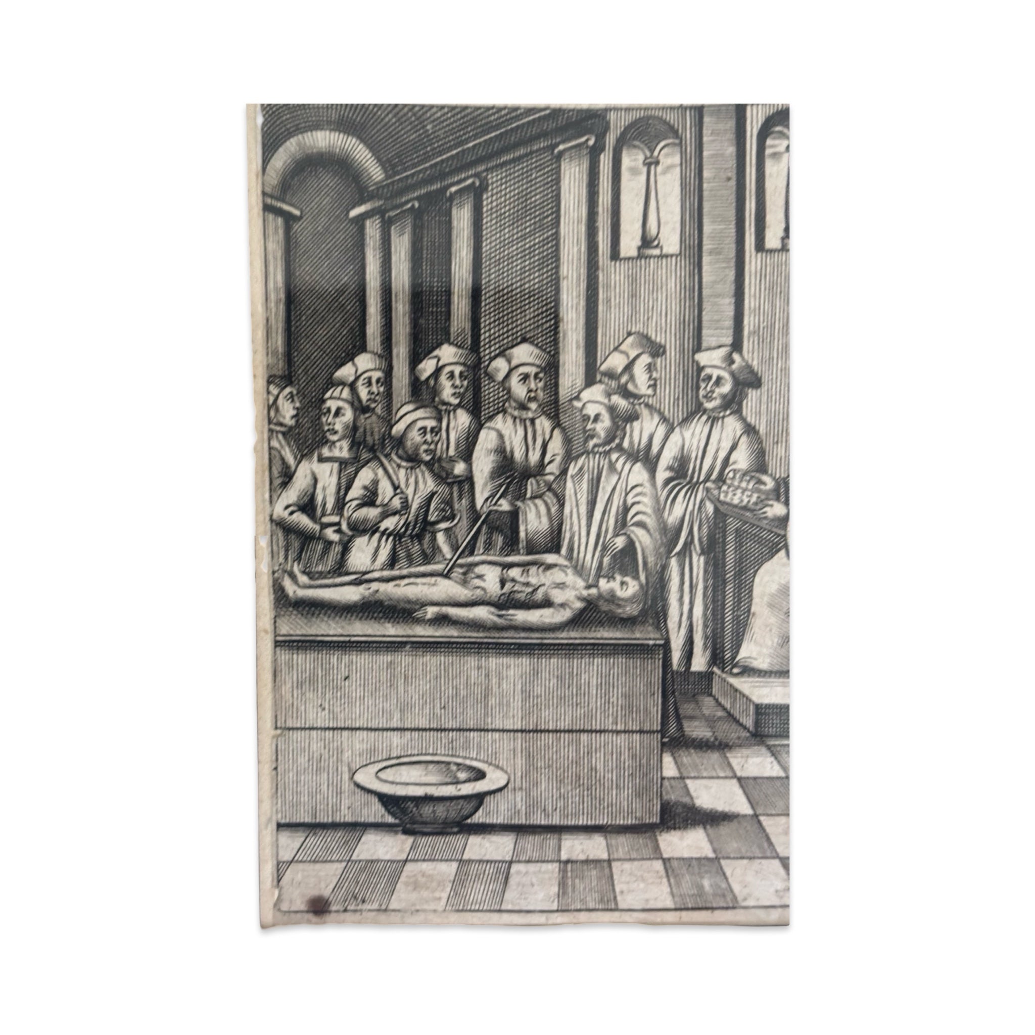 17th Century Print of a Scene at an Anatomy Lesson or Post Mortem